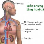 Bệnh Cao Huyết Áp sử dụng Đông Trùng Hạ Thảo có khỏi?